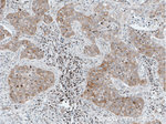 FOXO3A Antibody in Immunohistochemistry (Paraffin) (IHC (P))