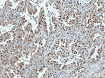 FOXO3A Antibody in Immunohistochemistry (Paraffin) (IHC (P))