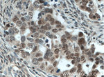 FOXO3A Antibody in Immunohistochemistry (Paraffin) (IHC (P))