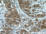 FOXO3A Antibody in Immunohistochemistry (Paraffin) (IHC (P))