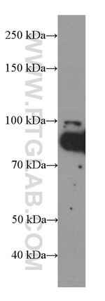 FOXO3A Antibody in Western Blot (WB)