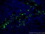 PLEK Antibody in Immunohistochemistry (PFA fixed) (IHC (PFA))