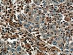 PLEK Antibody in Immunohistochemistry (Paraffin) (IHC (P))