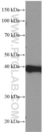 PLEK Antibody in Western Blot (WB)