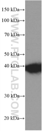 PLEK Antibody in Western Blot (WB)