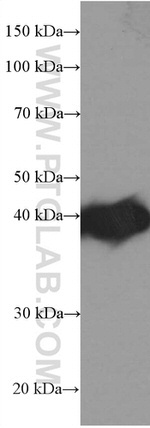 PLEK Antibody in Western Blot (WB)