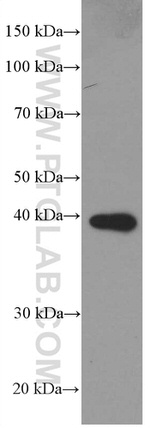 PLEK Antibody in Western Blot (WB)