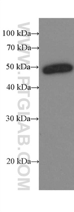 Amphiregulin Antibody in Western Blot (WB)