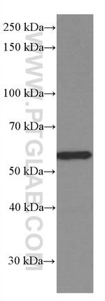 GDI1 Antibody in Western Blot (WB)