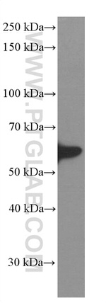 GDI1 Antibody in Western Blot (WB)