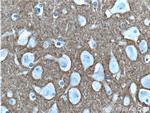 Syntaxin 1A / Syntaxin 1B Antibody in Immunohistochemistry (Paraffin) (IHC (P))