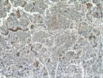 PEBP1 Antibody in Immunohistochemistry (Paraffin) (IHC (P))