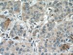 PEBP1 Antibody in Immunohistochemistry (Paraffin) (IHC (P))