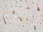 KChIP1 Antibody in Immunohistochemistry (Paraffin) (IHC (P))