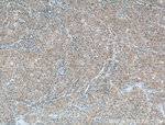 PDCD10 Antibody in Immunohistochemistry (Paraffin) (IHC (P))