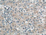 PDCD10 Antibody in Immunohistochemistry (Paraffin) (IHC (P))