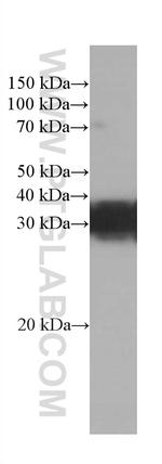 RGS4 Antibody in Western Blot (WB)