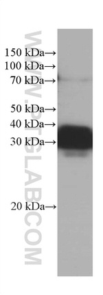 RGS4 Antibody in Western Blot (WB)