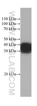 RGS4 Antibody in Western Blot (WB)