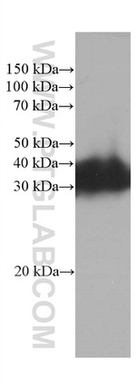 RGS4 Antibody in Western Blot (WB)