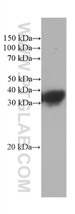 RGS4 Antibody in Western Blot (WB)