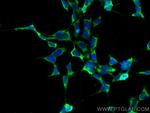 Hsc70 Antibody in Immunocytochemistry (ICC/IF)