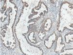 Hsc70 Antibody in Immunohistochemistry (Paraffin) (IHC (P))