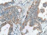 Hsc70 Antibody in Immunohistochemistry (Paraffin) (IHC (P))