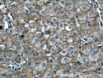 CD147 Antibody in Immunohistochemistry (Paraffin) (IHC (P))