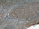 CD147 Antibody in Immunohistochemistry (Paraffin) (IHC (P))