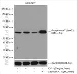 Phospho-AKT (Ser473) Antibody in Western Blot (WB)