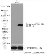 Phospho-AKT (Ser473) Antibody in Western Blot (WB)