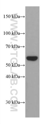 Phospho-AKT (Ser473) Antibody in Western Blot (WB)