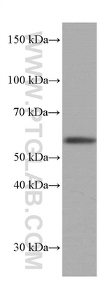 Phospho-AKT (Ser473) Antibody in Western Blot (WB)