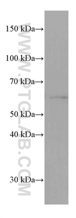 Phospho-AKT (Ser473) Antibody in Western Blot (WB)