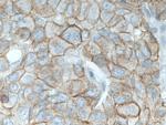 gamma catenin Antibody in Immunohistochemistry (Paraffin) (IHC (P))