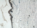 gamma catenin Antibody in Immunohistochemistry (Paraffin) (IHC (P))