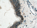 gamma catenin Antibody in Immunohistochemistry (Paraffin) (IHC (P))