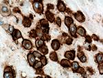 HLA-G Antibody in Immunohistochemistry (Paraffin) (IHC (P))