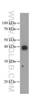 HLA-G Antibody in Western Blot (WB)