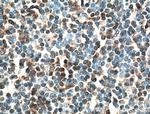 IRF4 Antibody in Immunohistochemistry (Paraffin) (IHC (P))