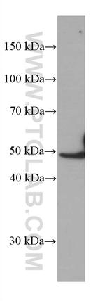 IRF4 Antibody in Western Blot (WB)