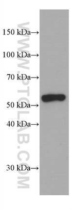 IRF4 Antibody in Western Blot (WB)