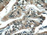 ZO-1 Antibody in Immunohistochemistry (Paraffin) (IHC (P))