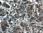 ZO-1 Antibody in Immunohistochemistry (Paraffin) (IHC (P))