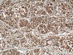 GNPAT Antibody in Immunohistochemistry (Paraffin) (IHC (P))