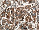 GNPAT Antibody in Immunohistochemistry (Paraffin) (IHC (P))