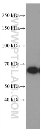 GNPAT Antibody in Western Blot (WB)