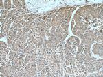 SERPINA7 Antibody in Immunohistochemistry (Paraffin) (IHC (P))