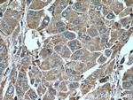 SERPINA7 Antibody in Immunohistochemistry (Paraffin) (IHC (P))